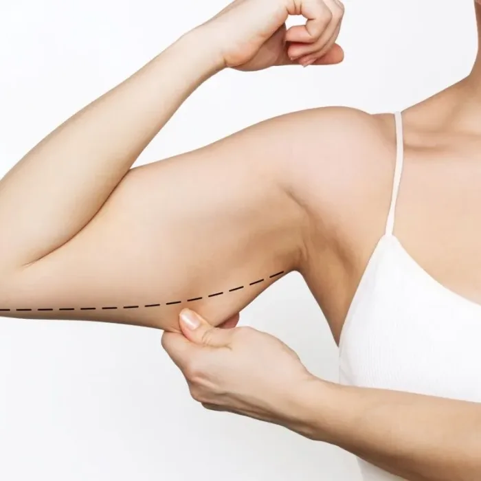 Bioestimuladores em estética corporal Bioestimuladores em estética corporal