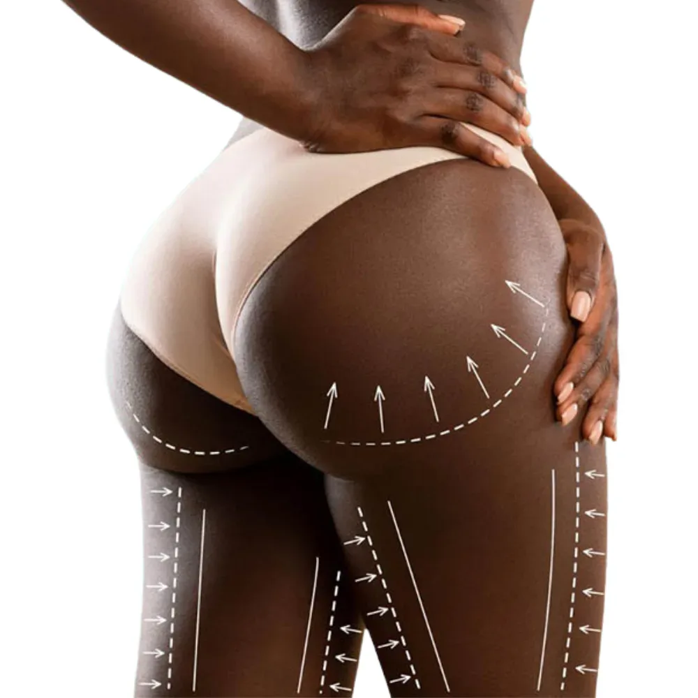 harmonizacao-de-gluteos harmonizacao-de-gluteos